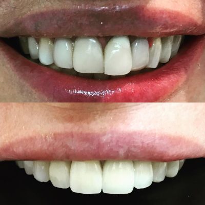 sorriso-3